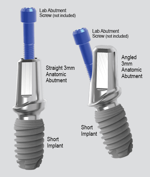 Anatomic Abutments AA Complete Dental Implant Solutions Anatomic Abutments AA Complete Dental Implant Solutions