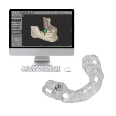 Treatment Planning and CBCT Surgical Guide