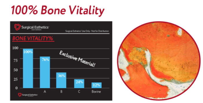 bone vitality website image