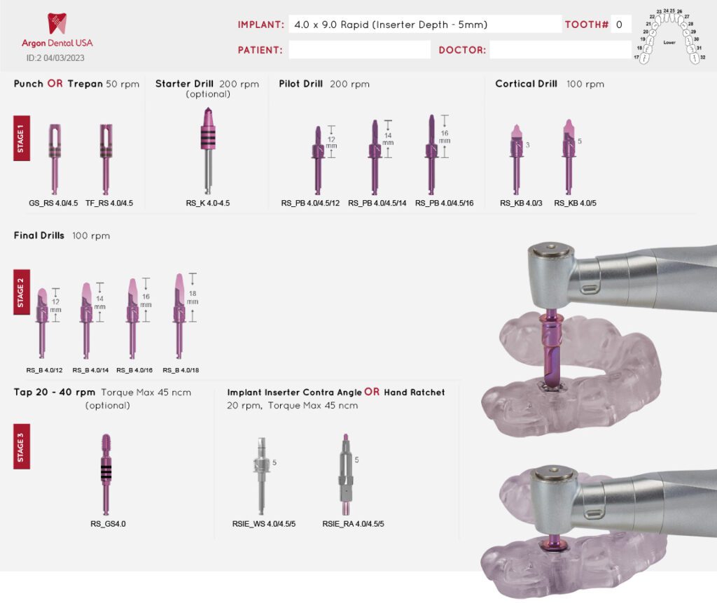 Argon K3 Pro Complete Dental Implant Solutions
