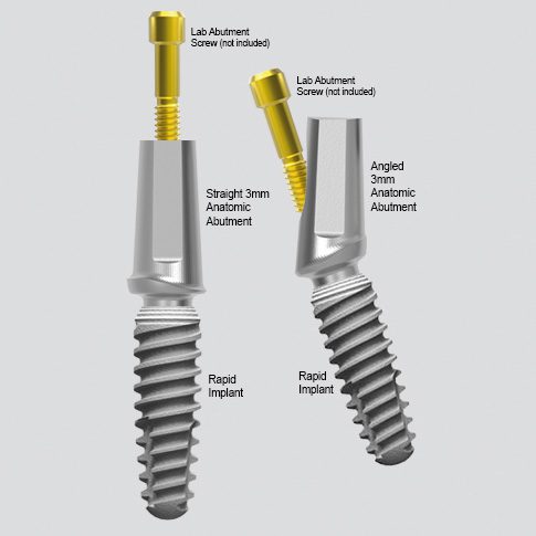 AA with 3mm implant rapid peek for web 485x485