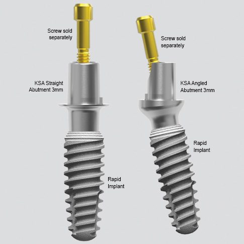 KSA with 3mm implant rapid for web 485x485